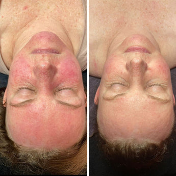 Understand How to Repair and Protect your Skin Barrier for Healthy Glowing Skin.