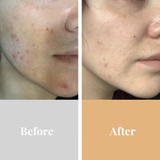 Omnilux™ Clear Mask